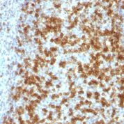 Formalin-fixed, paraffin-embedded human Tonsil stained with PD1 (CD279) MAb (PDCD1/922).