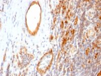 Formalin-fixed, paraffin-embedded human Tonsil stained with CD31 Monoclonal Antibody (1A1)