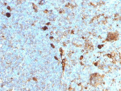 Western Blot of recombinant Alpha-1-Antitrypsin, Jurkat and A549 Cell Lysate using Alpha-1-Antitrypsin Monoclonal Antibody (AAT/1378).