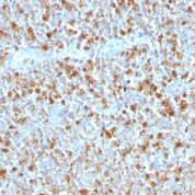 Formalin-fixed, paraffin-embedded human Tonsil stained with Alpha-1-Antitrypsin Monoclonal Antibody (AAT/1379)