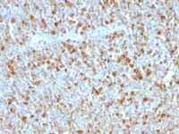 Formalin-fixed, paraffin-embedded human Tonsil stained with Alpha-1-Antitrypsin Monoclonal Antibody (AAT/1379)