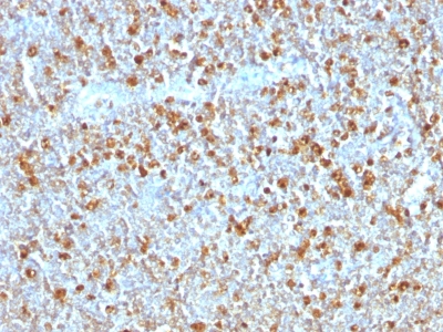 Formalin-fixed, paraffin-embedded human Tonsil stained with Alpha-1-Antitrypsin Monoclonal Antibody (AAT/1379)