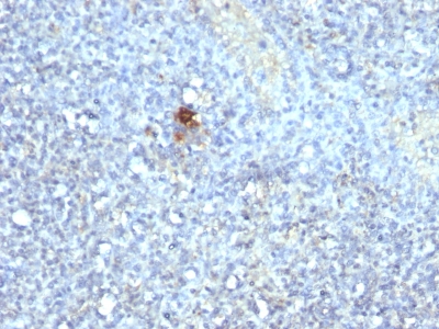 Formalin-fixed, paraffin-embedded human Spleen stained with TRAcP Monoclonal Antibody (ACP5/17)