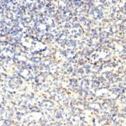 Formalin-fixed, paraffin-embedded human Spleen stained with TRAcP Monoclonal Antibody (SPM61)