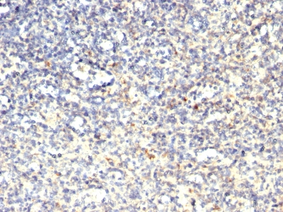 Formalin-fixed, paraffin-embedded human Spleen stained with TRAcP Monoclonal Antibody (SPM61)