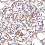 Flow Cytometry of NCCIT Cells using Podocalyxin Monoclonal Antibody (3D3).