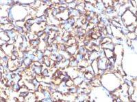 Flow Cytometry of NCCIT Cells using Podocalyxin Monoclonal Antibody (3D3).