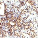 Formalin-fixed, paraffin-embedded human Placenta stained with Podocalyxin Monoclonal Antibody (2A4).