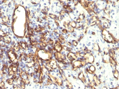 Formalin-fixed, paraffin-embedded human Placenta stained with Podocalyxin Monoclonal Antibody (2A4).