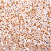 Formalin-fixed, paraffin-embedded human Pituitary Gland stained with ACTH Monoclonal Antibody (AH26 + 57).
