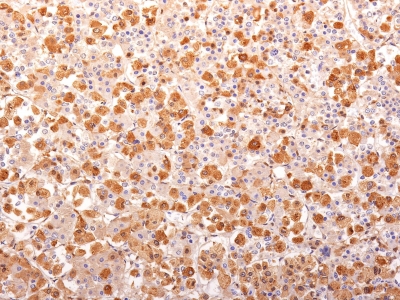 Formalin-fixed, paraffin-embedded human Pituitary Gland stained with ACTH Monoclonal Antibody (AH26 + 57).