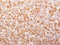 Formalin-fixed, paraffin-embedded human Pituitary Gland stained with ACTH Recombinant Mouse Monoclonal Antibody (r57).