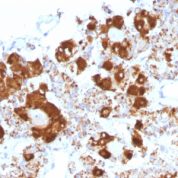Formalin-fixed, paraffin-embedded Human Pituitary stained with ACTH Monoclonal Antibody (CLIP/147).