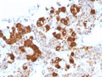 Formalin-fixed, paraffin-embedded Human Pituitary stained with ACTH Monoclonal Antibody (CLIP/147).