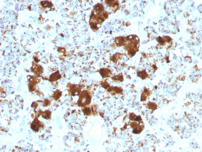Formalin-fixed, paraffin-embedded Human Pituitary stained with ACTH Monoclonal Antibody (SPM51).
