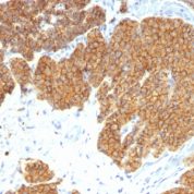 Formalin-fixed, paraffin-embedded human Parathyroid stained with PTH Monoclonal Antibody (3H9).