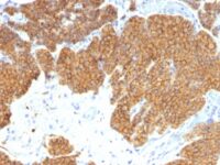 Formalin-fixed, paraffin-embedded human Parathyroid stained with PTH Monoclonal Antibody (3H9).