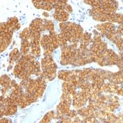 Formalin-fixed, paraffin-embedded human Parathyroid stained with PTH Monoclonal Antibody (PTH/911).