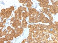 Formalin-fixed, paraffin-embedded human Parathyroid stained with PTH Monoclonal Antibody (PTH/911).