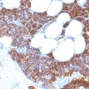 Formalin-fixed, paraffin-embedded human Parathyroid stained with PTH Monoclonal Antibody (SPM64).
