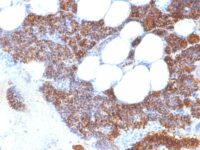 Formalin-fixed, paraffin-embedded human Parathyroid stained with PTH Monoclonal Antibody (SPM64).