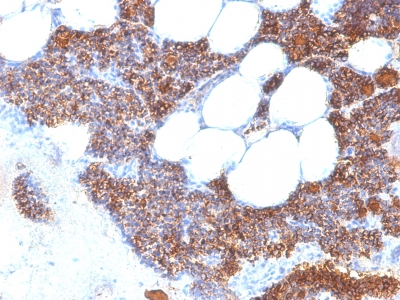 Formalin-fixed, paraffin-embedded human Parathyroid stained with PTH Monoclonal Antibody (SPM64).
