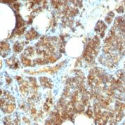 Formalin-fixed, paraffin-embedded human Parathyroid stained with PTH Monoclonal Antibody (PTH/1173).