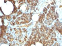 Formalin-fixed, paraffin-embedded human Parathyroid stained with PTH Monoclonal Antibody (PTH/1173).