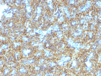 Formalin-fixed, paraffin-embedded human Parathyroid stained with PTH Monoclonal Antibody (PTH/1174).