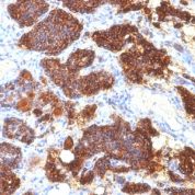 Formalin-fixed, paraffin-embedded human Parathyroid stained with PTH Monoclonal Antibody (PTH/1175).