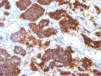 Formalin-fixed, paraffin-embedded human Parathyroid stained with PTH Monoclonal Antibody (PTH/1175).