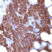 Formalin-fixed, paraffin-embedded human Parathyroid stained with PTH Monoclonal Antibody (3H9 + PTH/1175).