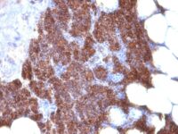 Formalin-fixed, paraffin-embedded human Parathyroid stained with PTH Monoclonal Antibody (3H9 + PTH/1175).