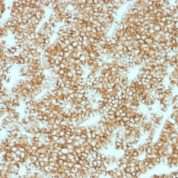Formalin-fixed, paraffin-embedded human Parathyroid stained with PTH Recombinant Rabbit Monoclonal Antibody (PTH/1717R).