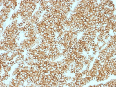Formalin-fixed, paraffin-embedded human Parathyroid stained with PTH Recombinant Rabbit Monoclonal Antibody (PTH/1717R).