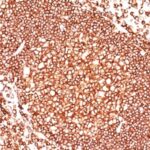 Formalin-fixed, paraffin-embedded human Tonsil stained with CD45 Monoclonal Antibody (136-4B5).