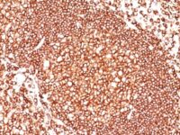 Formalin-fixed, paraffin-embedded human Tonsil stained with CD45 Monoclonal Antibody (136-4B5).