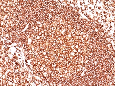 Formalin-fixed, paraffin-embedded human Tonsil stained with CD45 Monoclonal Antibody (136-4B5).