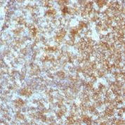 Formalin-fixed, paraffin-embedded human Tonsil stained with CD45 Monoclonal Antibody (SPM496).