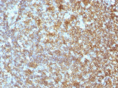 Formalin-fixed, paraffin-embedded human Tonsil stained with CD45 Monoclonal Antibody (SPM496).