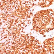 Formalin-fixed, paraffin-embedded human Tonsil stained with CD45RB Monoclonal Antibody (DF-B1).