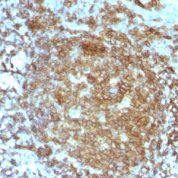 Formalin-fixed, paraffin-embedded human Tonsil stained with CD45RA Monoclonal Antibody (PTPRC/818).
