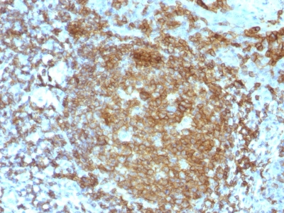 Formalin-fixed, paraffin-embedded human Tonsil stained with CD45RA Monoclonal Antibody (PTPRC/818).