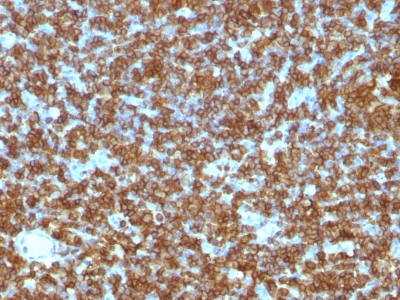 Formalin-fixed paraffin-embedded human Tonsil stained with CD45RA Monoclonal Antibody (PTPRC/1131).