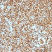Formalin-fixed, paraffin-embedded human Tonsil stained with CD45RB Monoclonal Antibody (PTPRC/1147).
