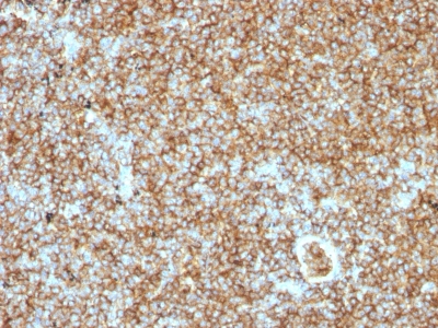 Formalin-fixed, paraffin-embedded human Tonsil stained with CD45RB Monoclonal Antibody (PTPRC/1147).