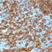 Formalin-fixed, paraffin-embedded human Tonsil stained with CD45RA Monoclonal Antibody (PTPRC/1148).