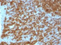 Formalin-fixed, paraffin-embedded human Tonsil stained with CD45RA Monoclonal Antibody (PTPRC/1148).