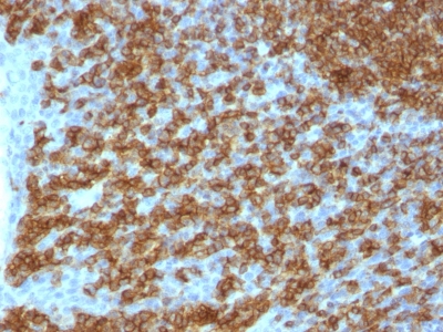 Formalin-fixed, paraffin-embedded human Tonsil stained with CD45RA Monoclonal Antibody (PTPRC/1148).