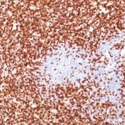 Formalin-fixed, paraffin-embedded human Tonsil stained with  CD45RO Monoclonal Antibody (UCHL-1 + T2/797).